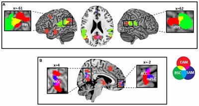 Common Recruitment of Angular Gyrus in Episodic Autobiographical Memory and Bodily Self-Consciousness